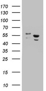 DDX6 Antibody in Western Blot (WB)