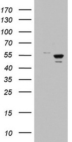 DDX6 Antibody in Western Blot (WB)