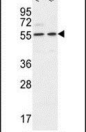 DDX6 Antibody in Western Blot (WB)