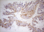 DECR1 Antibody in Immunohistochemistry (Paraffin) (IHC (P))