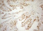 DECR1 Antibody in Immunohistochemistry (Paraffin) (IHC (P))