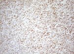 DECR1 Antibody in Immunohistochemistry (Paraffin) (IHC (P))