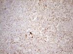 DECR1 Antibody in Immunohistochemistry (Paraffin) (IHC (P))