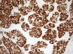 DECR1 Antibody in Immunohistochemistry (Paraffin) (IHC (P))