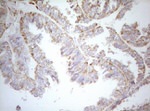 DECR1 Antibody in Immunohistochemistry (Paraffin) (IHC (P))