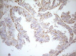 DECR1 Antibody in Immunohistochemistry (Paraffin) (IHC (P))
