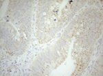 DECR1 Antibody in Immunohistochemistry (Paraffin) (IHC (P))