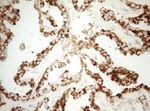 DECR1 Antibody in Immunohistochemistry (Paraffin) (IHC (P))