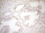 DECR1 Antibody in Immunohistochemistry (Paraffin) (IHC (P))