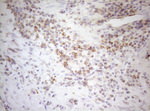 DECR1 Antibody in Immunohistochemistry (Paraffin) (IHC (P))