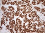 DECR1 Antibody in Immunohistochemistry (Paraffin) (IHC (P))