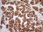 DECR1 Antibody in Immunohistochemistry (Paraffin) (IHC (P))