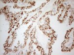 DECR1 Antibody in Immunohistochemistry (Paraffin) (IHC (P))