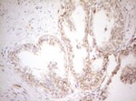 DECR1 Antibody in Immunohistochemistry (Paraffin) (IHC (P))