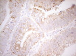 DECR1 Antibody in Immunohistochemistry (Paraffin) (IHC (P))