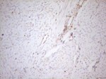 DECR1 Antibody in Immunohistochemistry (Paraffin) (IHC (P))