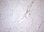 DECR1 Antibody in Immunohistochemistry (Paraffin) (IHC (P))
