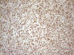 DECR1 Antibody in Immunohistochemistry (Paraffin) (IHC (P))