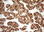 DECR1 Antibody in Immunohistochemistry (Paraffin) (IHC (P))
