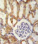beta-Defensin 1 Antibody in Immunohistochemistry (IHC)