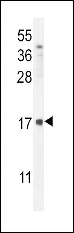 beta-Defensin 1 Antibody in Western Blot (WB)