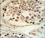 DEK Antibody in Immunohistochemistry (IHC)