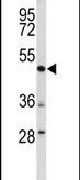 DEK Antibody in Western Blot (WB)