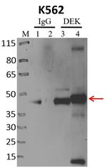 DEK Antibody in Immunoprecipitation (IP)
