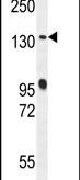 DENND5A Antibody in Western Blot (WB)