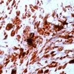 Desmin Antibody in Immunohistochemistry (IHC)