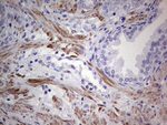 DES Antibody in Immunohistochemistry (Paraffin) (IHC (P))