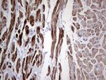 DES Antibody in Immunohistochemistry (Paraffin) (IHC (P))