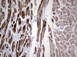 DES Antibody in Immunohistochemistry (Paraffin) (IHC (P))