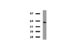 DES Antibody in Western Blot (WB)