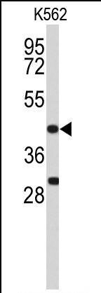 ICAD Antibody in Western Blot (WB)