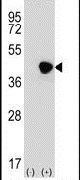 ICAD Antibody in Western Blot (WB)