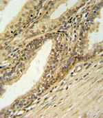 DFFB Antibody in Immunohistochemistry (IHC)