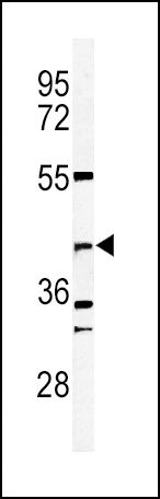 DFFB Antibody in Western Blot (WB)