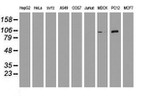 DGKA Antibody in Western Blot (WB)