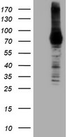 DGKA Antibody in Western Blot (WB)