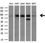 DGKA Antibody in Western Blot (WB)