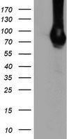 DGKA Antibody in Western Blot (WB)