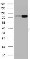 DGKB Antibody in Western Blot (WB)