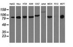 DGKB Antibody in Western Blot (WB)