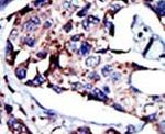 DGKD Antibody in Immunohistochemistry (IHC)