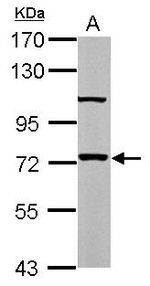 DGKE Antibody in Western Blot (WB)