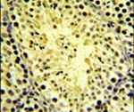 DGKK Antibody in Immunohistochemistry (IHC)