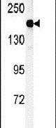 DGKK Antibody in Western Blot (WB)