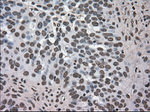 DHFR Antibody in Immunohistochemistry (Paraffin) (IHC (P))
