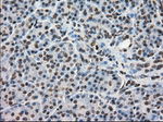 DHFR Antibody in Immunohistochemistry (Paraffin) (IHC (P))